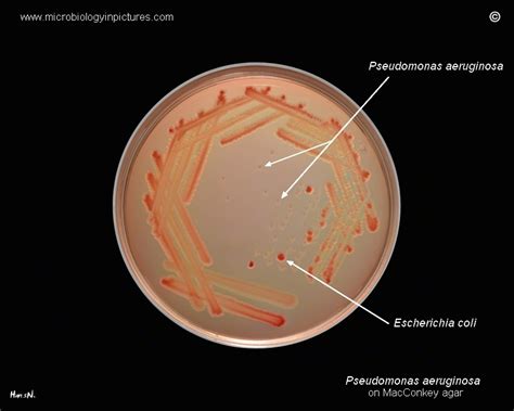 pseudomonas on macconkey agar
